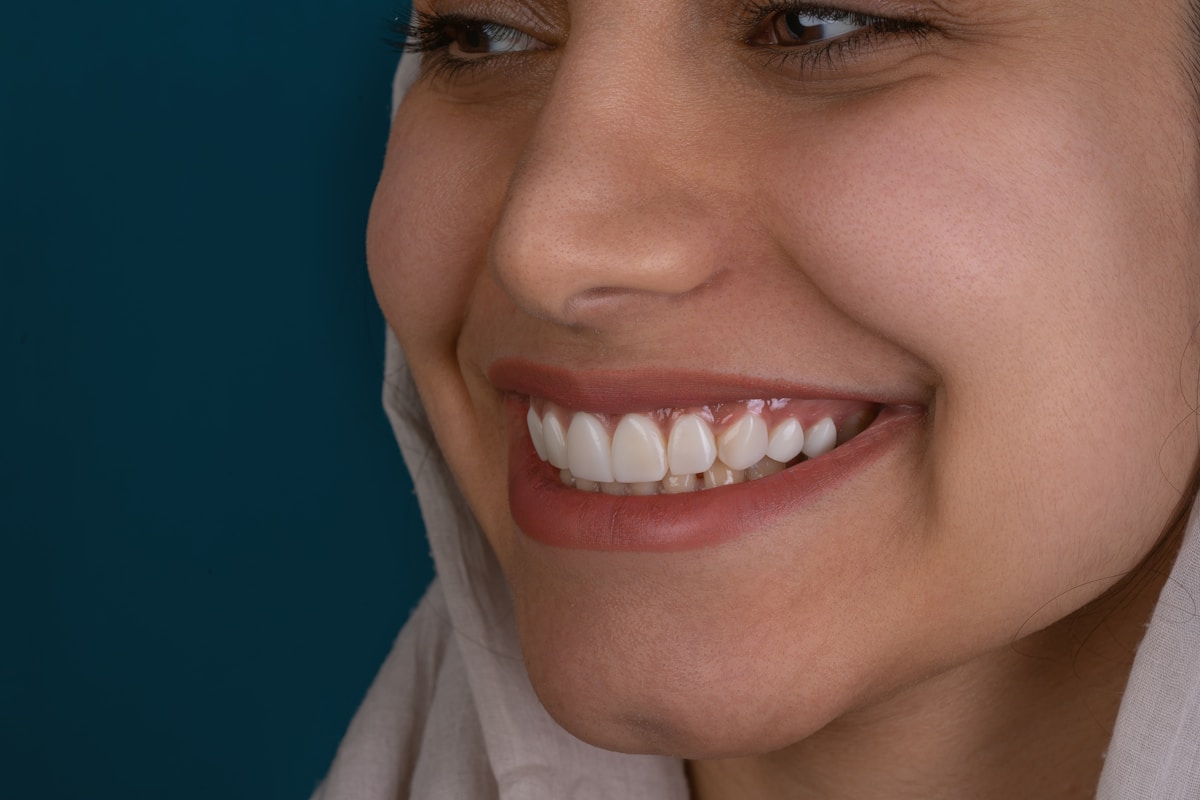 Beautiful smile after dental veneers